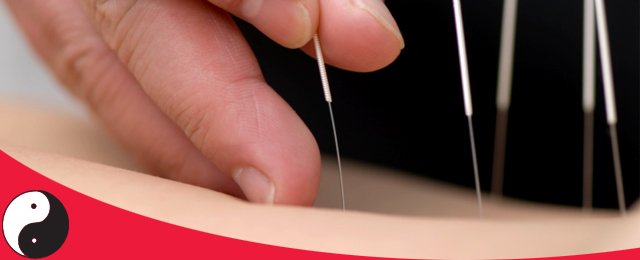 Acupuncture treatment